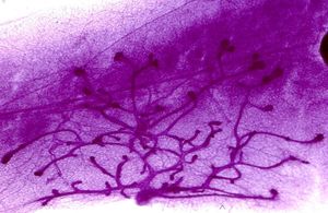 Co může způsobit smrtící marketing farmaceutického průmyslu?, Andrea Procházková, Erik Tabery